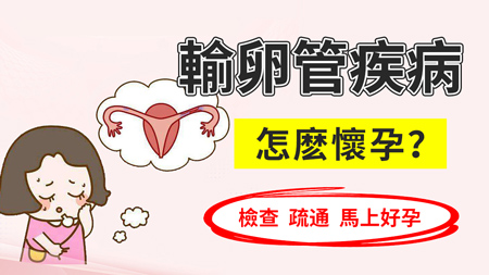 98695997.jpg 輸卵管1.jpg